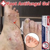 Foot Antifungal Cream 20g Itchy Skin Cream Athletes Foot Treatment Relief Itchy Fungal Infection Her