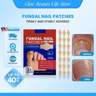 【M'SIA SHIP OUT 24HRS】Luckinwish Nail Repair Patches - 21pcs Strengthening Toenail Stickers for Brit