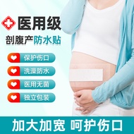 Medical Caesarean section Waterproof Patch Postpartum Surgery Bath Dedicated Wound Knife Edge Breath