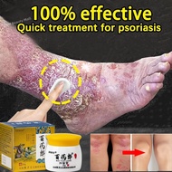 eczema bai yao lang cream psoriasis anti-itch ointment private part antibacterial cream anti fungal