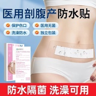 2025 New Style Cut Belly Production Medical Wound Waterproof Sticker Zhandi Cut Belly Production Wat