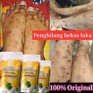 sabun penghilang bekas luka hitam lama penghilang bekas koreng bekas cacar penghilang panu kadas kur