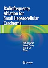 Radiofrequency Ablation for Small Hepatocellular Carcinoma