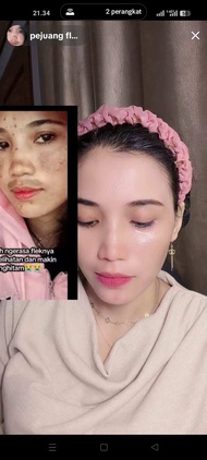 JS SKINCARE KRIM FLEK AMPUH