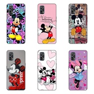 Honor 70 Honor 50 Honor X9 5g X8 5g X7 X6 10x lite Mickey Mouse Series phone case