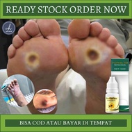 Obat Luka Diabetes Obat Perawatan Luka Diabets Obat Pengering Luka Diabetes Obat Luka Diabetes Kerin
