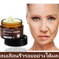 【นำเข้าจากญี่ปุ่น เกาหลี 】ครีมเรตินอลแท้ ครีมลดริ้วรอย ครีมบำรุงผิวหน้า retinol cream ครีมลบริ้วรอย ครีมต่อต้านริ้วรอย ครีมทาหน้าขาว กระชับ ยกกระชับ เรตินอลครีม เรตินอลครีมแท้ ครีมบำรุงของเกาหลี  30g