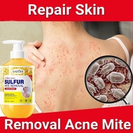 500ml Sulphur Shower gel back acne and sulfur mite removal shower gel,whitening and moisturizing ski