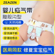 Infant Hernia Fixation Belt for Boys and Girls, Groin Type Special Hernia Treatment Rehabilitation C