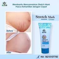 Aleya strechmark Cream Penghilang Bekas Luka Keloid Obat Strechmark Obat Penghilang Selulit Bpom Amp