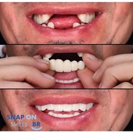 PUTIH Original Money Back Guarantee Snap on smile Upper And Lower Dentures Original Dentures Removab