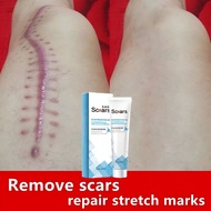 Krim hilangkan parut Hilangkan Parut kaki Krim hilangkan parut hitam removal Stretch Marks Burns Sca