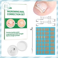 Adfz 1/2 Set Ingrown Toenail Corrector Tools Pedicure Recover Embed Toenail Treatment Foot Care Corr