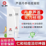 仁和 祛痘膏痘肌草本修护凝胶淡化痘疤痘坑青春学生去痘精华男女 芦荟丹参祛痘凝胶1支装