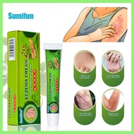 eczema cream itchy skin medication ringworm medication psoriasis cream itchy skin cream Chinese herb
