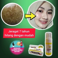 KRIM769 UNTUK MASALAH JERAGAT JERAWAT PARUT