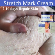 Stretch Mark Cream Pregnancy Cream Krim stretch mark ibu mengandung Remove Stretch Mark Repair Skin 