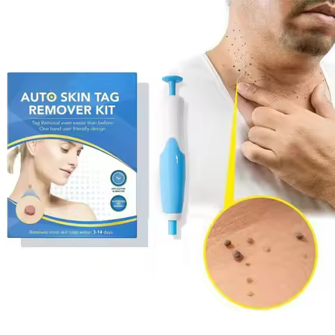 Painless Wart Removal Device Laser Verrucae Remover for Plantar/Wart/Flat Wart Home Use Treatment