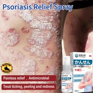 Ubat gatal Ubat kurap Psoriasis spray Ubat eczema Antibacterial Spray Quick Anti Itch Eczema Relief 
