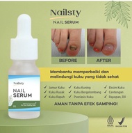 TERBUKTI 3X PAKAI Obati Kuku Rusak Berjamur Cantengan Obat Kuku Busuk Paling Ampuh Kuku Kaki Kuku Ta