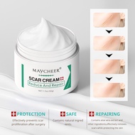 Acne Scar Remover Old Scar Scarminator Cream Stretch Mark Remover Scar Removal Pimple Mark Remover I
