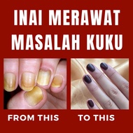 INAI SERBUK MERAWAT MASALAH KUKU - SERBUK INAI ASLI 100% NATURAL