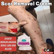 Ouhoe Scar Remover Cream  Advanced  Mild Operation Scar Gel Dermatic Scar Remover for Stretch Marks 