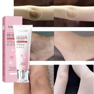 Whitening cream Private area neck whitening Miss V cream armpit whitening Cream whitening groin remo