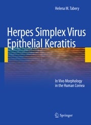 Herpes Simplex Virus Epithelial Keratitis Helena M. Tabery