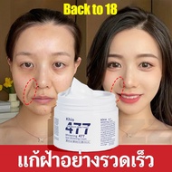 477 ครีมแก้ฝ้าผิวขาว ครีมทาฝ้า ครีมไวท์เทนนิ่ 50g อุดมไปด้วยไนอาซินาไมด์ ยับยั้งการสร้างเมลามิน ทาผิ