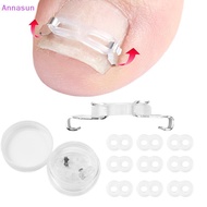 Annasun 1/2 Set Ingrown Toenail Corrector Tools Pedicure Recover Embed Toenail Treatment Professiona