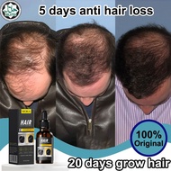 hair growth oil serum rambut lebat hair growth serum 生發水 30ml anti hair fall Strengthens hair roots 