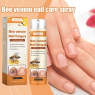 🔥Nail Care Spray Suitable for people Features care cream Portable Health Nail Care Spray Nail care a