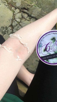 Kem Bong Da BODY Chành Ni