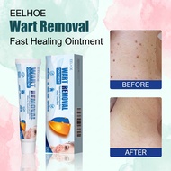 Warts Remover Ointment 20g Facial Mole Removal Wart Removal Skin Tag Remover Wart Removal Cream 克疣膏 