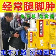 Hot Sale Edema Eliminate Leg Edema Foot Edema Face Edema Whole Body Lower Limb Floating Edema Draina