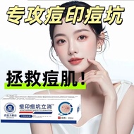 Acne marks, acne pit removal cream acne desalination acne ma#祛痘印祛痘坑祛痘膏粉刺淡化痘印学生痤疮修复祛痘膏去痘印医用03031