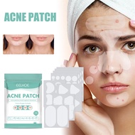 EELHOE acne patch acne mask patch fade imprint patch acne repair veneer care products 132pcs