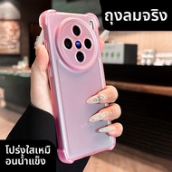 DAIMANG | เคสป้องกันลายนิ้วมือสำหรับ Vivo X200 Pro X200S X200Promini 100S
