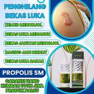 Obat Penghilang Bekas Luka Obat Keloid Menonjol Penghilang Luka Menonjol Bekas Luka Menahun Bekas Ja