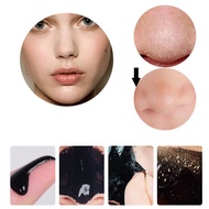 Mask Blackhead Remover Deep Cleansing Nose T Zone Mask Nose Pore Cleansing Strips Blackhead Remover 