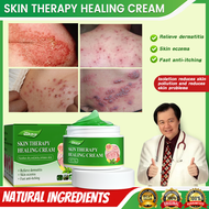 gamot sa kati kati sa balat skin fighter atoderma cream original ointments and creams eczema treatme