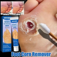 barang asli Ubat Ketuat Tapak Kaki Ubat Mata Ikan Penampal Ketuat Remover Foot Corn Remover Wart Rem