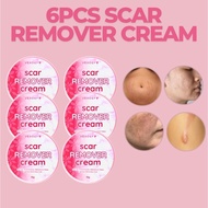 Scar & Stretchmarks Remover Cream Peklat Remover Acne Treatment Old Scar Remover Cream