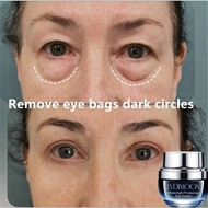LYDIMOON Eye Cream Eye Bag Removal Cream 30G