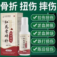 Joint Ligament Strain Sprain Muscles Bone Injury Swelling Pain Safflower Bone Broken Broken Injury S