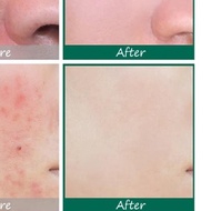 SOMEBYMI - AHA-BHA-PHA 30 Days Miracle SERUM 50mL