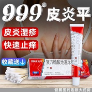 Keep on 999 itch relieving itching neurodermatitis chronic eczema dermatitis f三九皮炎平软膏999瘙痒止痒神经性皮炎慢性湿疹九九九39皮肤瘙痒my 7.16