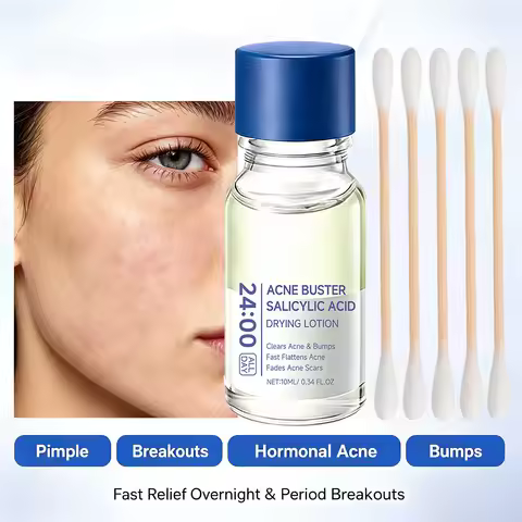 Salicylic Acid Acne Treatment Serum Spot Corrector with Niacinamide Pimple Relief Fades Acne Mark Oi