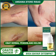 Propolis SM - Obat Keloid - Daging Tumbuh - Daging Jadi - Penghilang Keloid - Bekas Luka Menahun - P